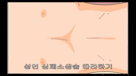 성인심폐소생술따라하기_big_001.jpg